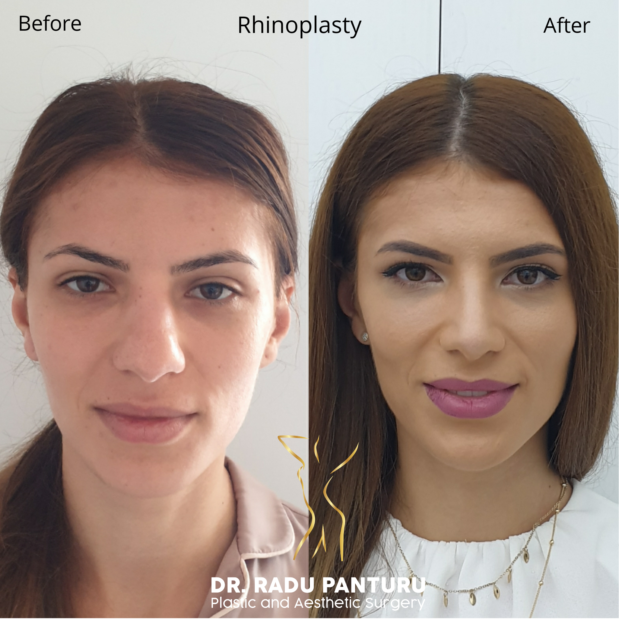 20200720_200327_0000-1