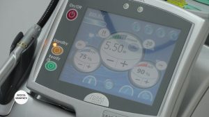 RS_OBREJA_PARODONTOZA_Moment11