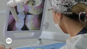 RS_CAZIMIR_LUCRARI PROTETICE_15.10.2020_Moment