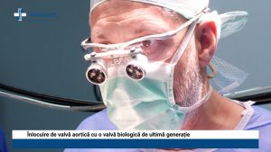 FILM CHIRURGIE CARDIACA DR. RURAC_3.06.2021_Moment