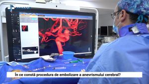 NEURORADIOLOGIE 3_Moment