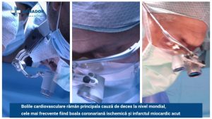 DR.-RURAC-BYPASS-CORONARIAN_Moment2