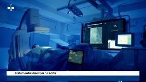 DISECTIE-DE-AORTA.00_01_55_00.Still005