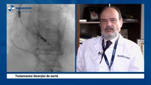 DISECTIE-DE-AORTA.00_04_48_46.Still006