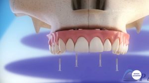 DINTI-FICSI-IN-24-DE-ORE.00_02_10_48.Still004