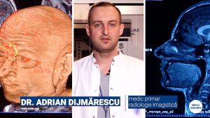 rmn-copy.00_00_28_21.Still001