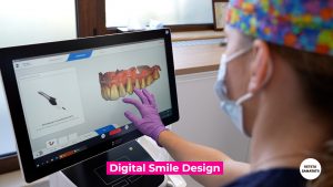 DIGITAL-SMILE-DESIGN.00_00_58_11.Still001