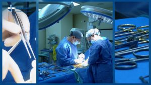 FISTULA-ARTERIOVENOASA.00_00_46_45.Still004