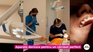 APARAT-DENTAR-FIX.00_02_33_06.Still003