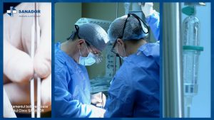 BOALA-VARICOASA.00_00_52_39.Still003