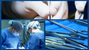 BOALA-VARICOASA.00_03_41_04.Still001