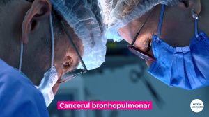 CANCER-BRONHOPULMONAR_PROF-CORDOS.00_00_20_13.Still004