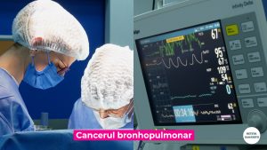 CANCER-BRONHOPULMONAR_PROF-CORDOS.00_00_49_15.Still006