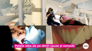 PETELE-DENTARE.00_02_30_10.Still001