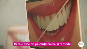 RETETA-SANATATII-_PETELE-DENTARE_11.09.2022_Moment