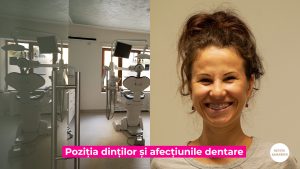 PARODONTITA-TRATATA-ORTODONTIC.00_02_42_33.Still001