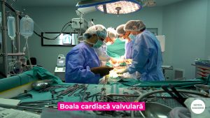 BOLILE-VALVULARE.00_00_12_15.Still008