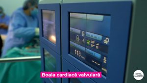 BOLILE-VALVULARE.00_00_15_10.Still007