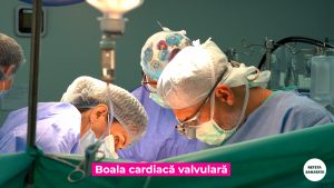 BOLILE-VALVULARE.00_00_20_25.Still009