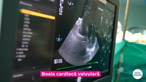 BOLILE-VALVULARE.00_00_26_33.Still005