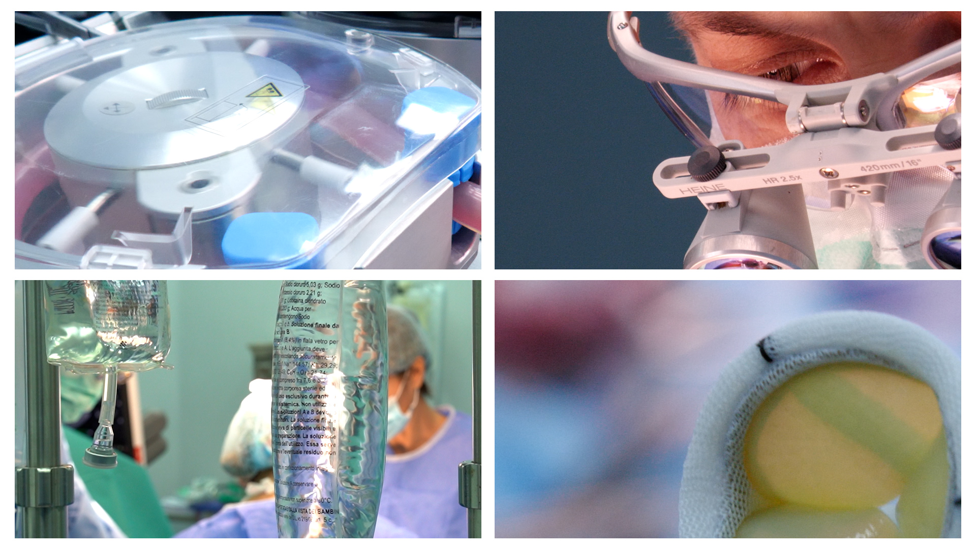 BOLILE-VALVULARE.00_02_27_29.Still011