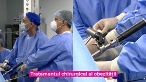 CHIRURGIE-BARIATRICA-_DR-TURCU.00_00_36_20.Still007