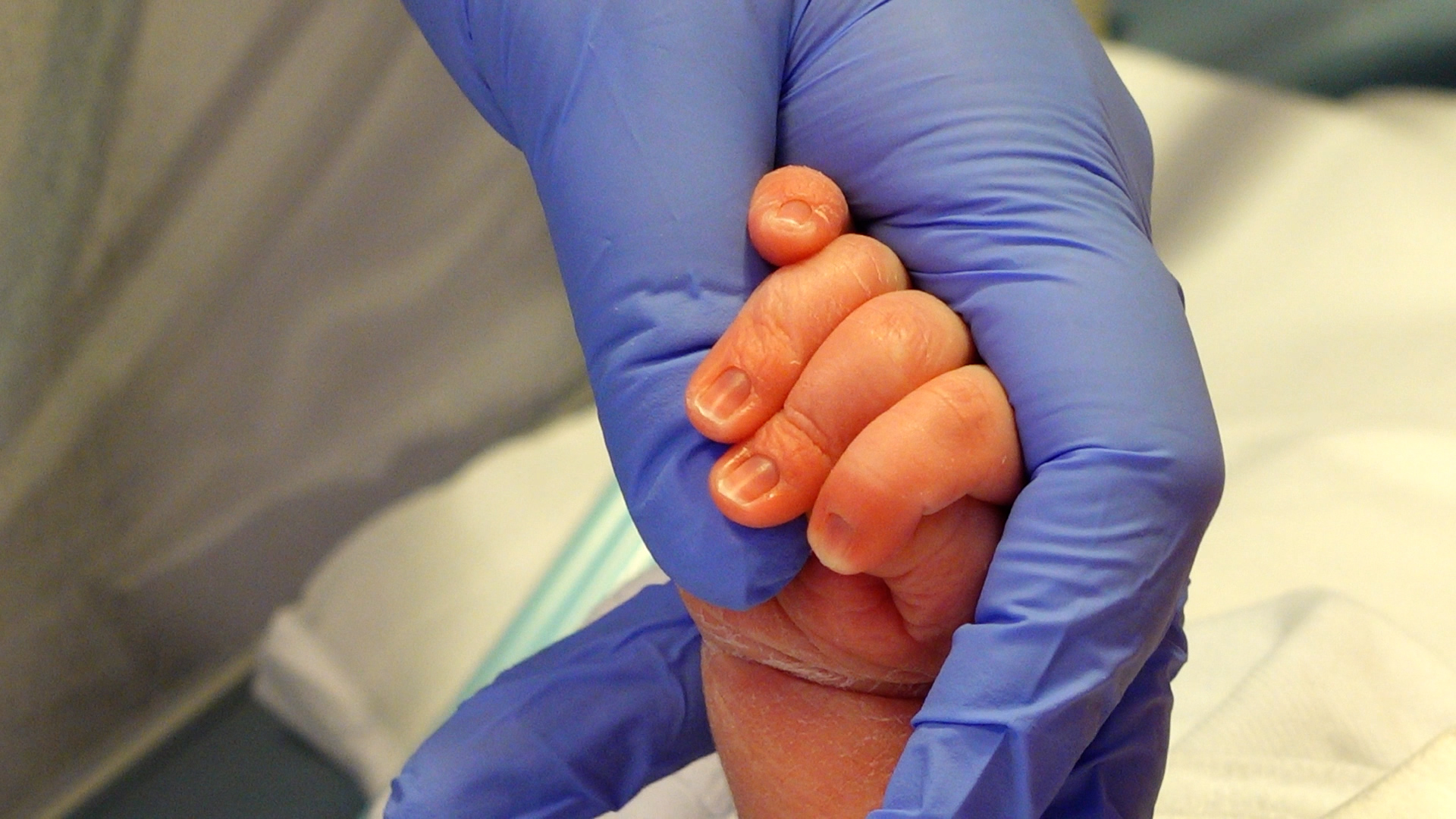 INGRIJIREA-PREMATURILOR-DR-PREDA.00_02_42_47.Still006