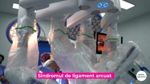 LIGAMENT-ARCUAT-DR-MARTIAN.00_00_12_28.Still004