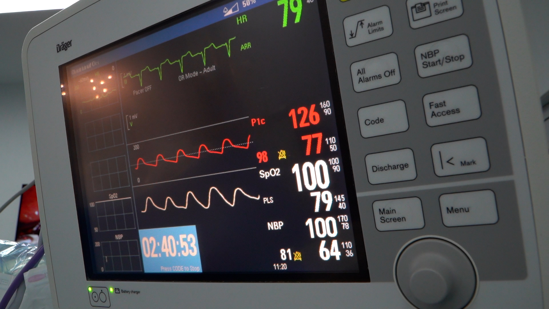 LIGAMENT ARCUAT – DR MARTIAN.00_00_17_15.Still008