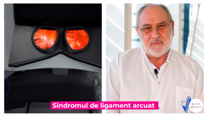 LIGAMENT-ARCUAT-DR-MARTIAN.00_01_51_09.Still001