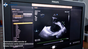 Tratamentul-endovascular-5-MIN.00_04_17_05.Still006