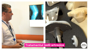 BOALA-ARTROZICA-DR-OJOGA.00_02_39_33.Still007