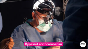 BYPASS-CORONARIAN-PROF-COSTACHE.00_01_27_48.Still007