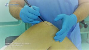 GONARTROZA-DR-DRAGOMIR.00_00_35_48.Still002-2