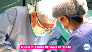 CHIRURGIA-CARDIACA-MINIM-INVAZIVA.00_00_16_17.Still006