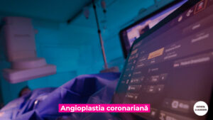 ANGIOPLASTIA-DR-NICULESCU.00_00_19_48.Still003