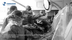 CAZ-COMPLEX-ANEVRISM.00_03_02_47.Still005