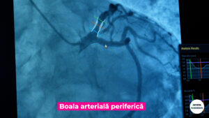 DR-ANDRADA-BOGDAN-Jet-Stream.00_02_38_35.Still006