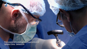 Protezarea-articulara-pentru-boala-artrozica.00_02_05_14.Still003