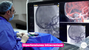 HIPERTENSIUNEA-INTRACRANIANA.00_02_00_23.Still005