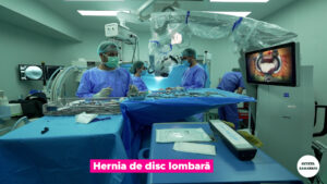 copy-hernia-.00_00_19_12.Still004