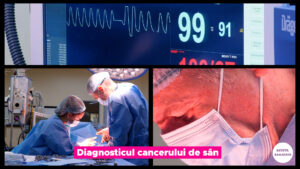 DIAGNOSTICUL-CANCERULUI-DE-SAN.00_01_29_40.Still002