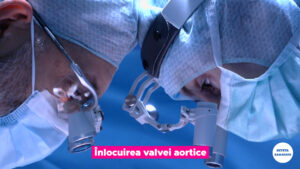 Chirurgia-valvei-aortice.00_02_40_16.Still005