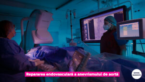 ANEVRISM-AORTA-ABDOMINALA-EVAR.00_01_12_25.Still007