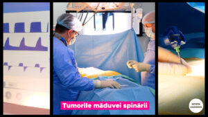 TUMORILE-MEDULARE.00_00_12_19.Still001