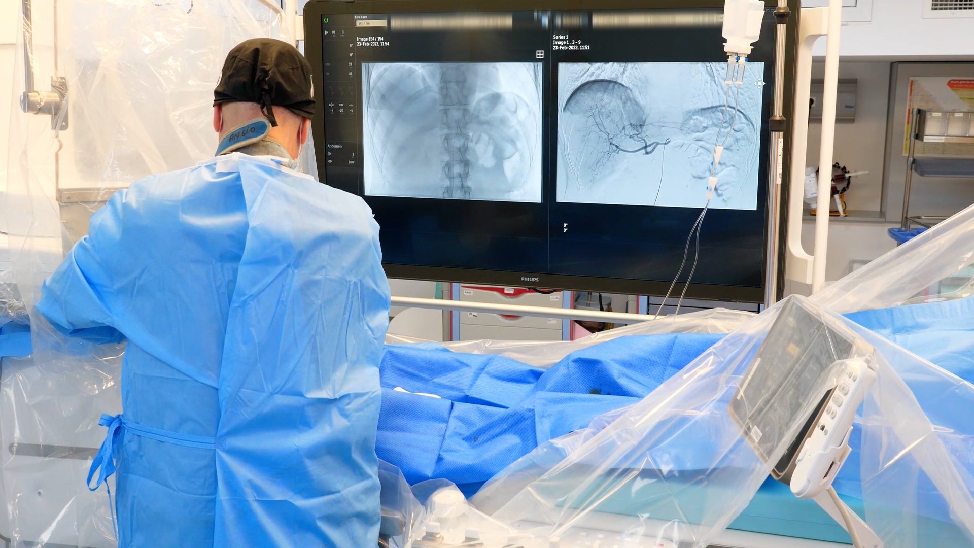 radiologia-interventionala.00_02_09_08.Still007