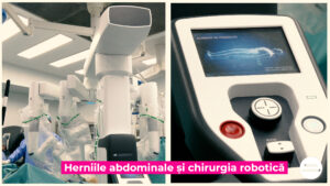 HERNIILE-ABDOMINALE-SI-CHIRURGIA-ROBOTICA.00_00_14_10.Still006