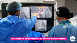 ANEVRISMUL-CEREBRAL.00_00_13_22.Still004