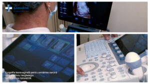 Ecografia-transvaginala-pentru-urmarirea-sarcinii.00_04_06_10.Still004