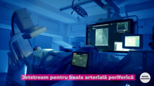 arteriopatia obliterantă.00_00_11_16.Still001